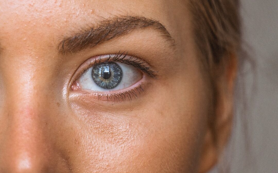 eyelid plasma lift