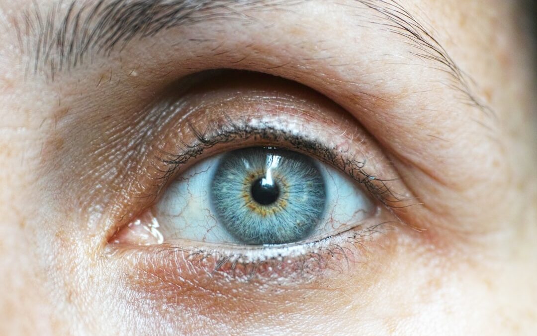 fibroblast eye lift