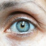 fibroblast eye lift