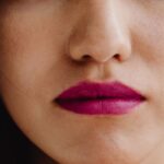 juvederm for lines around mouth