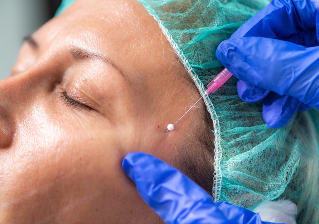 fibroblast plasma skin tightening treatment