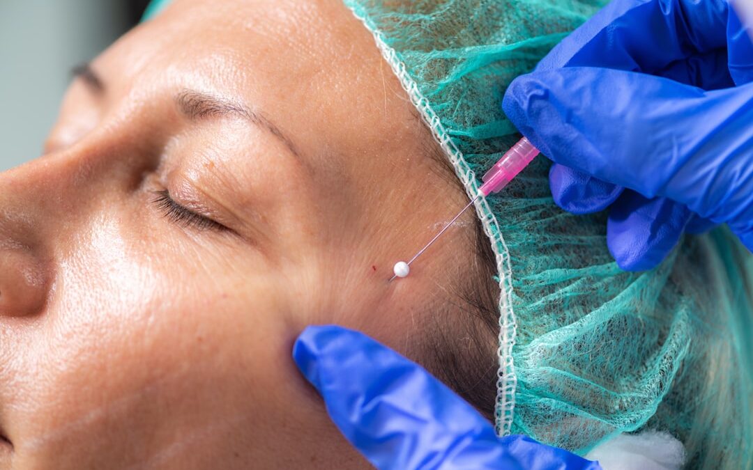 fibroblast plasma skin tightening treatment