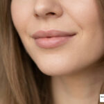 juvederm lips