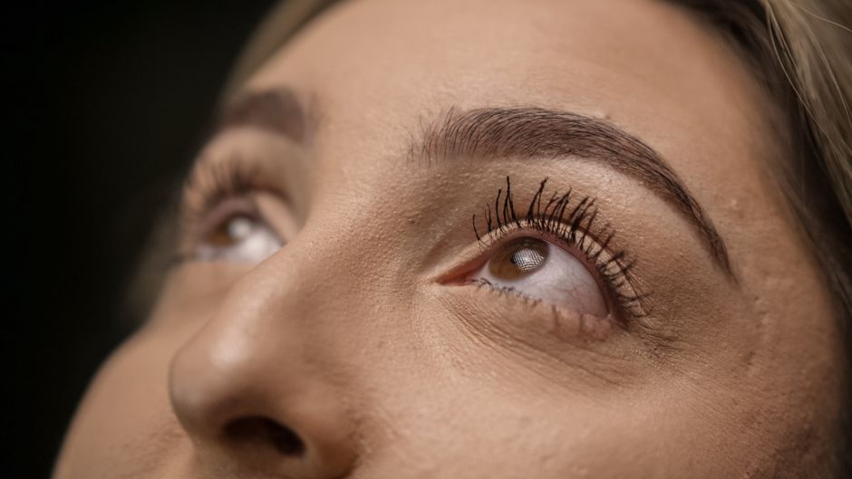 dysport brow lift