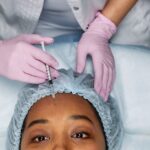 Dysport injection points on forehead and glabellar lines