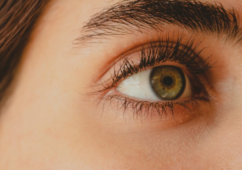 Botox under eyes