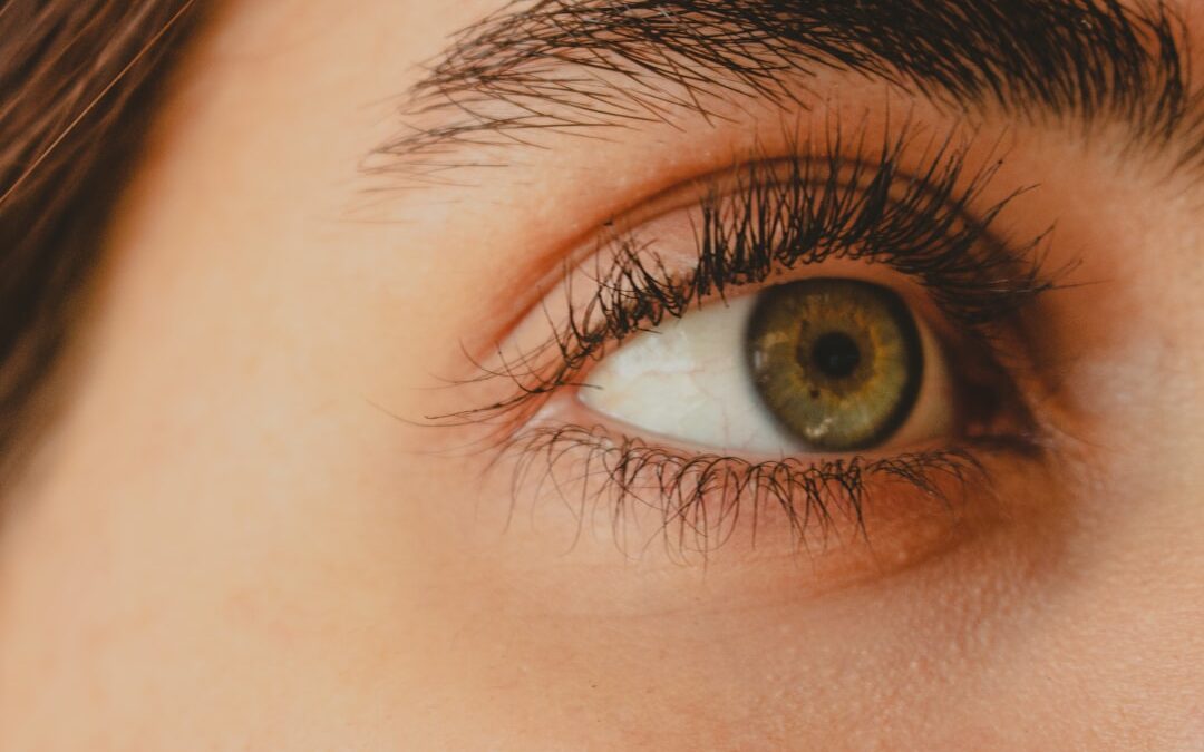 Botox under eyes