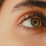 Botox under eyes